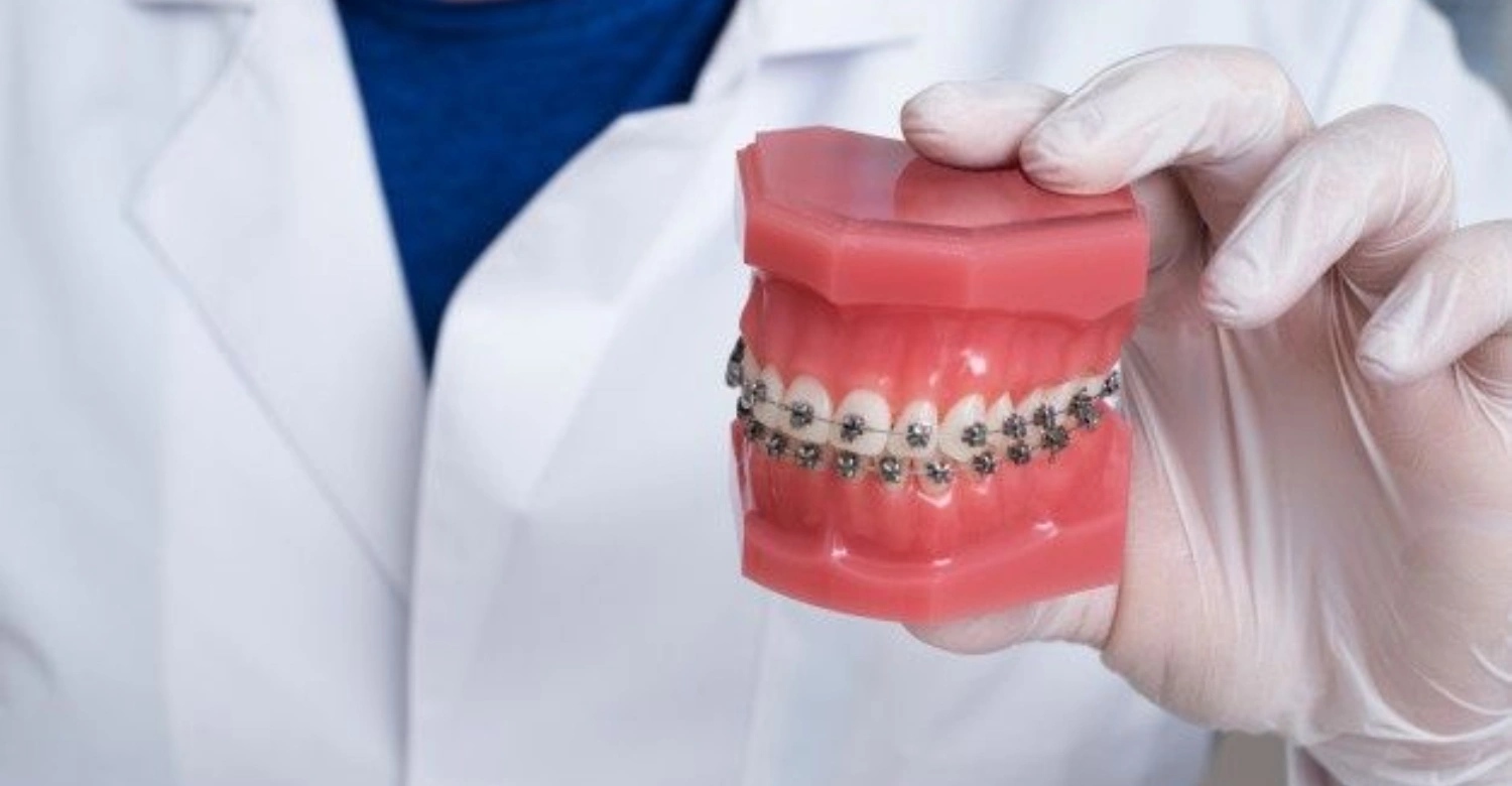 how to get orthodontic glue off teeth